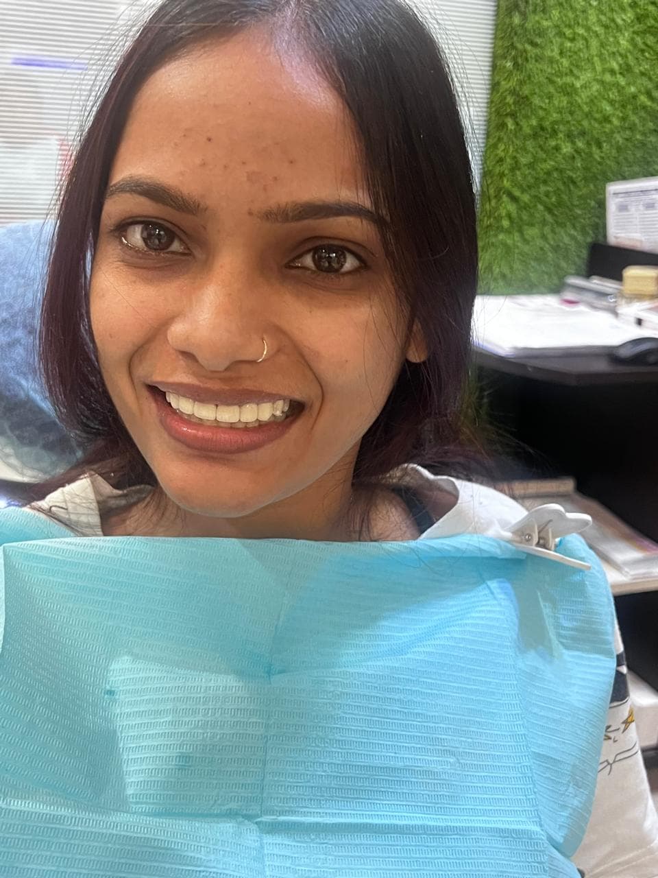 Root Canal Treatment